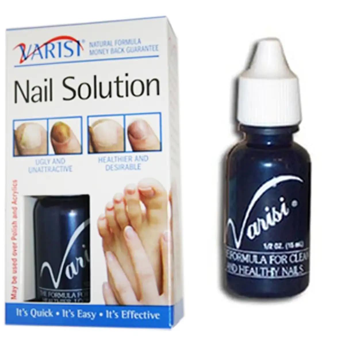 Varisi Fungus Treatment